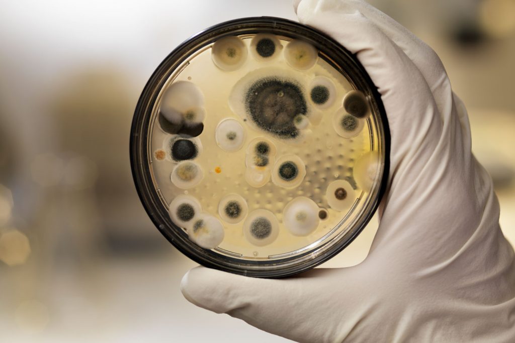 A scientist checking the agar plate filled with mold and bacteria's