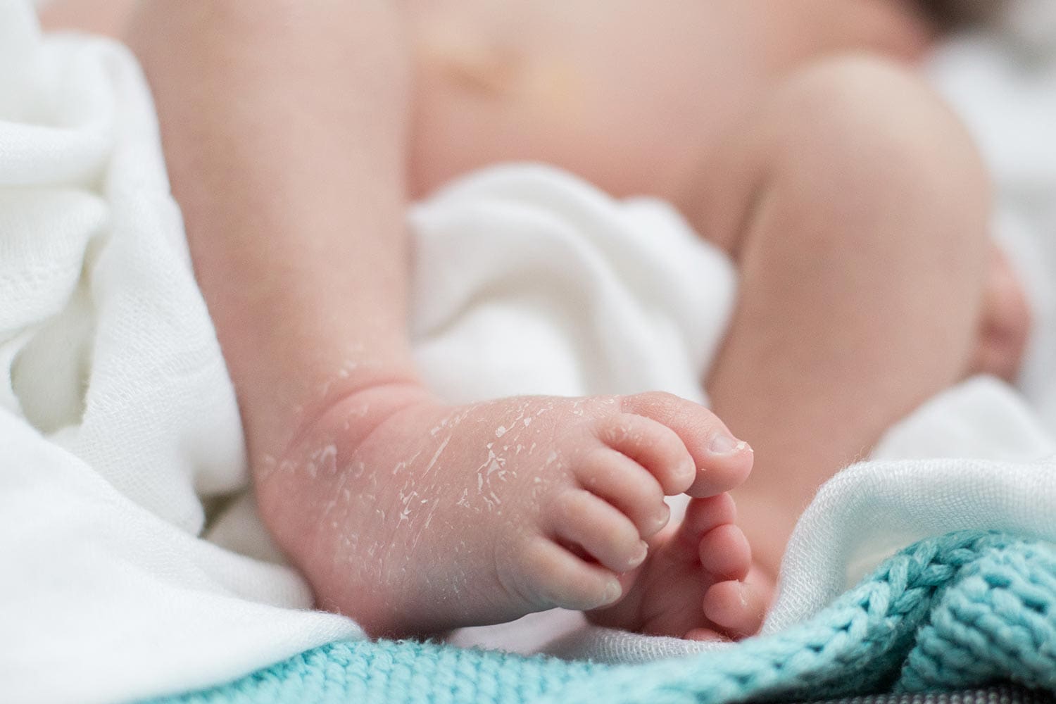 Dry skin newborn baby feet
