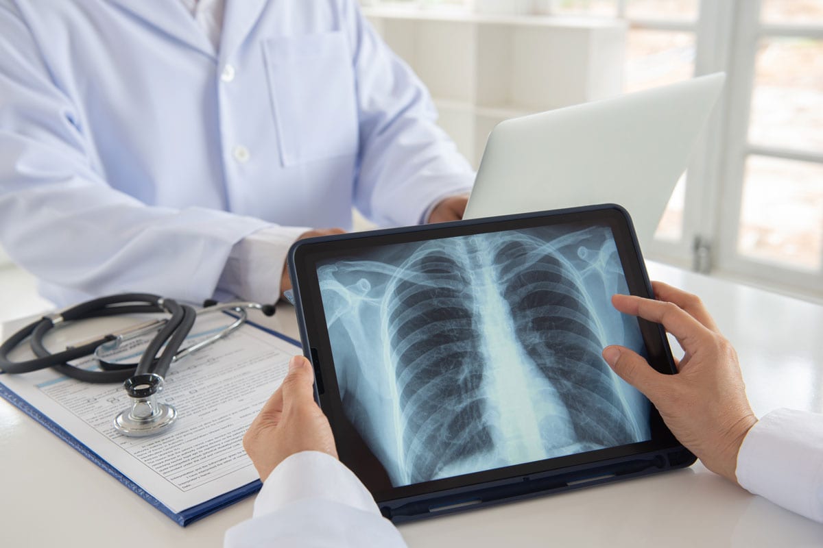 doctor team diagnose lung x-ray image on digital tablet screen with radiologic technologist team